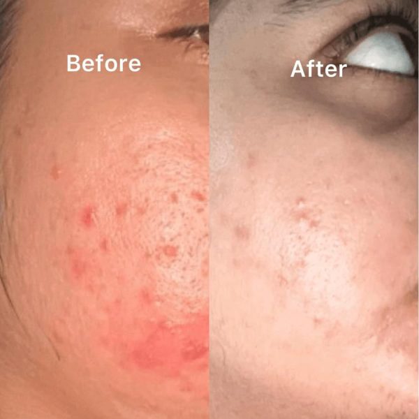 Nirvana Botanics- Vitamin C & E Serum 15 (ml)