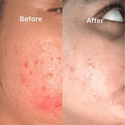 Nirvana Botanics- Vitamin C & E Serum 15 (ml)