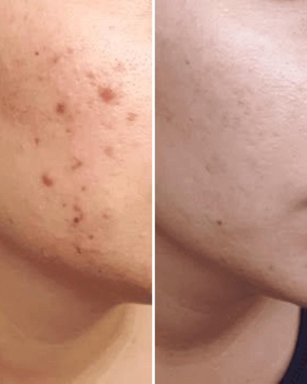 Nirvana Botanics- Vitamin C & E Serum 15 (ml)